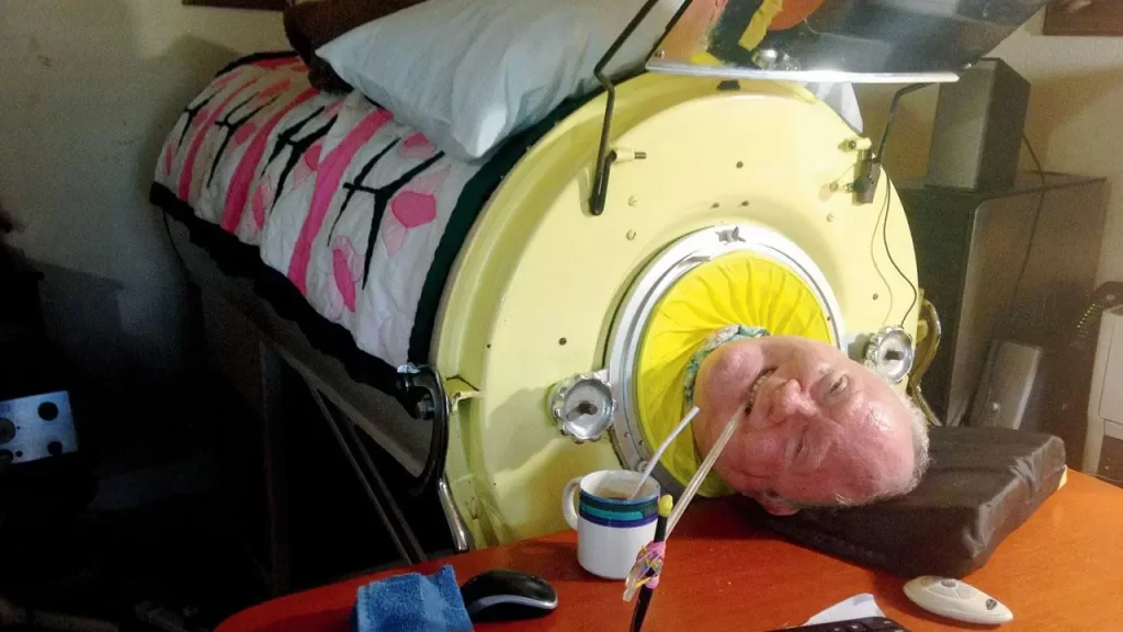 Paul Alexander: The Man Who Lived in an Iron Lung for 70 Years