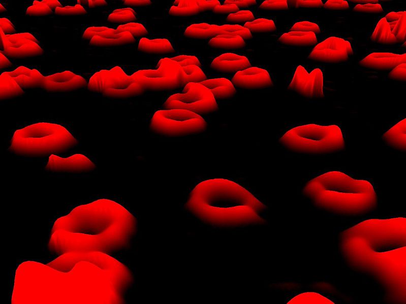Digital holographic microscopy (DHM) image of red blood cells. 