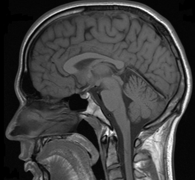 MRT scan of human head. 
