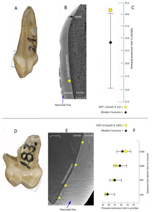 
The latest research, centered on five infant teeth uncovered at the Krapina location in Croatia, unveiled that the pace of Neanderthal juvenile growth outpaced the maturation timeline observed in contemporary humans.