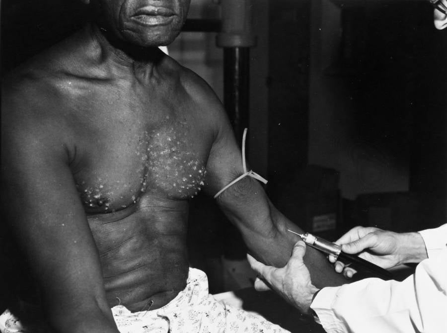 The Tuskegee syphilis study stands out as one of the most unethical experiments conducted in U.S. history.